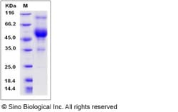 Sino Biological Rat CD83 Protein 100ug (Sino Biological), Quantity: Each