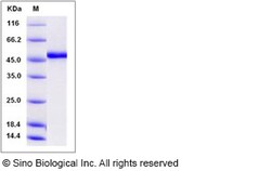 Sino Biological Human ADAMTSL1 Protein 100ug (Sino Biological), Quantity: