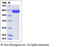 Sino Biological EpCAM Protein 100ug (Sino Biological), Quantity: Each of