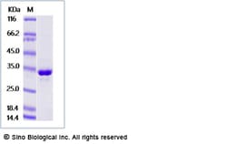 Sino Biological Cynomolgus FGL1 Protein 1MG (Sino Biological), Quantity: