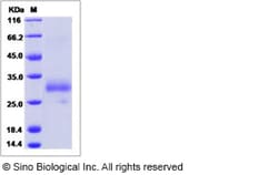 Sino Biological Cynomolgus EDA2R Protein 50ug (Sino Biological), Quantity: