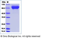 Sino Biological Rat SerpinF2 Protein 50ug (Sino Biological), Quantity: