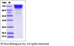Sino Biological Rat CDH13 Protein 100ug (Sino Biological), Quantity: Each