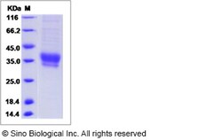 Sino Biological Cynomolgus IL20RB Protein 50ug (Sino Biological), Quantity: