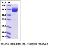 Sino Biological Cynomolgus PROCR Protein 100ug (Sino Biological), Quantity: