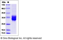 Sino Biological Rat CLEC4B2 Protein 100ug (Sino Biological), Quantity: