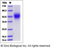 Sino Biological Rat SLAMF1 Protein 100ug (Sino Biological), Quantity: Each