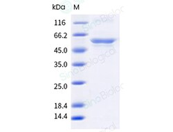 Sino Biological Car i 1 Protein 250ug (Sino Biological), Quantity: Each