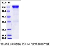Sino Biological Rat PDGFRB Protein 100ug (Sino Biological), Quantity: Each