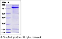 Sino Biological Rat CDH1 Protein 100ug (Sino Biological), Quantity: Each