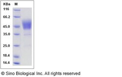 Sino Biological Rat CD24 Protein 100ug (Sino Biological), Quantity: Each