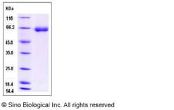 Sino Biological Mouse DPP7 Protein 50ug (Sino Biological), Quantity: Each