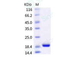 Sino Biological Human IL1B Protein 20ug (Sino Biological), Quantity: Each
