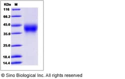 Sino Biological Cynomolgus CD58 Protein 100ug (Sino Biological), Quantity: