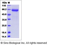 Sino Biological Rhesus FCN1 Protein 200ug (Sino Biological), Quantity: