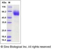Sino Biological Rat CD47 Protein 100ug (Sino Biological), Quantity: Each