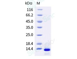 Sino Biological Recombinant Human, Rhesus, Cynomolgus, Canine TGF beta
