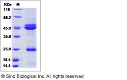 Sino Biological Recombinant Rabbit IL-23 Protein (His Tag), Quantity: Each