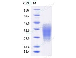 Sino Biological Human LIF Protein 100ug (Sino Biological), Quantity: Each