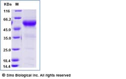 Sino Biological Recombinant Cynomolgus CD8 alpha Protein (ECD, hFc Tag),