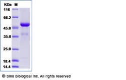 Sino Biological Cynomolgus TNFSF9 Protein 1MG (Sino Biological), Quantity:
