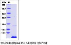 Sino Biological Rat CD81 Protein 100ug (Sino Biological), Quantity: Each