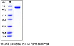 Sino Biological Mouse VCAM1 Protein 1MG (Sino Biological), Quantity: Each