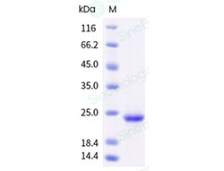 Sino Biological Recombinant Human KGF/FGF-7 Protein (His Tag), HPLC-verified,