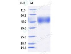 Sino Biological Human IL7RA & IL2RG Protein 1MG (Sino Biological), Quantity:
