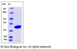 Sino Biological Cynomolgus YWHAB Protein 100ug (Sino Biological), Quantity: