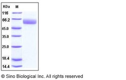 Sino Biological Mouse SERPINA7 Protein 50ug (Sino Biological), Quantity: