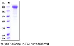 Sino Biological Human NCSTN Protein 50ug (Sino Biological), Quantity: Each