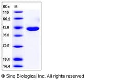 Sino Biological Mouse CPA1 Protein 50ug (Sino Biological), Quantity: Each