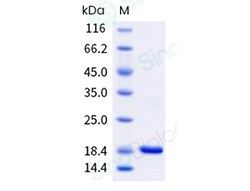 Sino Biological Human IL1A Protein 20ug (Sino Biological), Quantity: Each