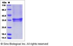 Sino Biological Rhesus AGRP Protein 200ug (Sino Biological), Quantity: