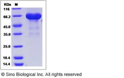 Sino Biological Human GALNT10 Protein 50ug (Sino Biological), Quantity:
