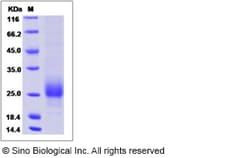 Sino Biological Human CGA Protein 50ug (Sino Biological), Quantity: Each