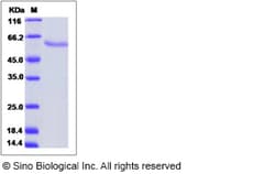 Sino Biological Sus scrofa (Pig) LGMN Protein 50ug (Sino Biological), Quantity: