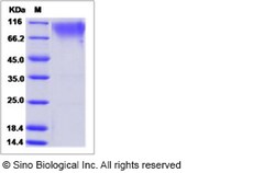 Sino Biological Recombinant Cynomolgus CD164 Protein (ECD, hFc Tag), Quantity: