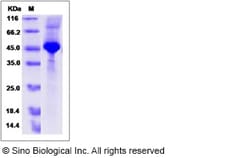 Sino Biological Rhesus IFNB1 Protein 100ug (Sino Biological), Quantity: