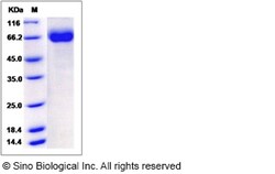 Sino Biological Rat CD226 Protein 100ug (Sino Biological), Quantity: Each