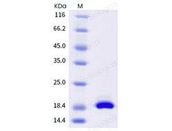Sino Biological Human IL7 Protein 1MG (Sino Biological), Quantity: Each