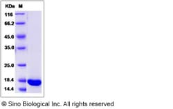 Sino Biological Rat REG3A Protein 100ug (Sino Biological), Quantity: Each