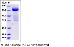 Sino Biological Human IL17RB Protein 1MG (Sino Biological), Quantity: Each