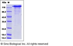 Sino Biological Rhesus SELP Protein 200ug (Sino Biological), Quantity: