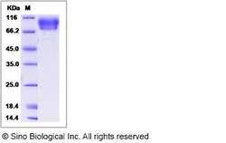 Sino Biological Recombinant Cynomolgus E-Selectin/CD62E Protein (His Tag),