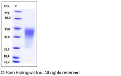Sino Biological Mouse LIF Protein 1MG (Sino Biological), Quantity: Each