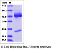 Sino Biological IL12B & IL23A Protein 50ug (Sino Biological), Quantity: