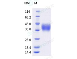 Sino Biological Rhesus FCGR3 Protein 100ug (Sino Biological), Quantity: