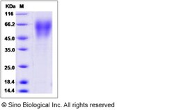 Sino Biological CD86 Protein 1MG (Sino Biological), Quantity: Each of 1